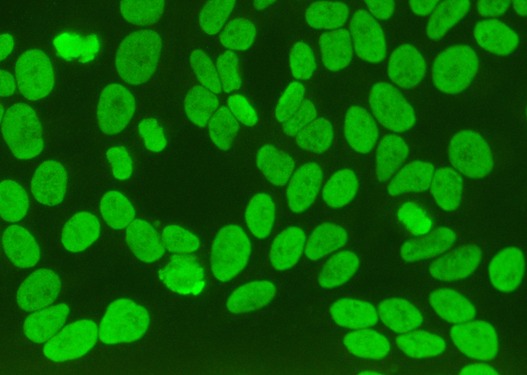 FAN — Facteurs Antinucléaires (AAN)