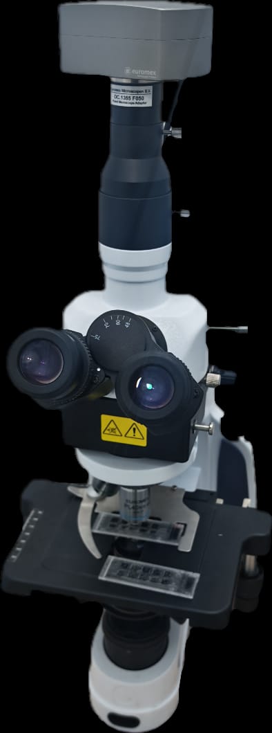 تحليل ASMA / AAML — الأجسام المضادة للعضلات الملساء