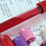 Les Étapes à Suivre pour les Analyses de Fertilité