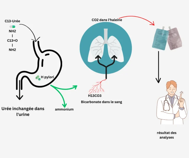 Nos Services : Test Respiratoire pour Helicobacter Pylori