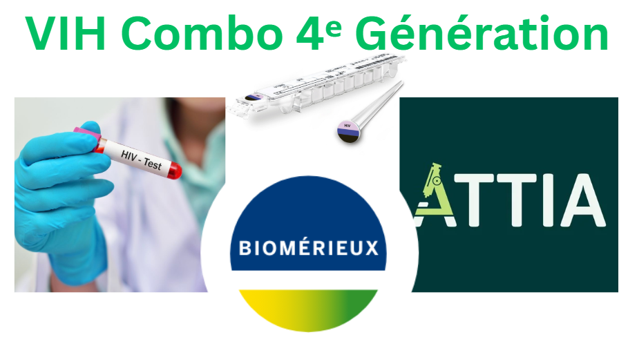 Test VIH Combo 4ème génération disponible au laboratoire ATTIA Alger (Kouba)